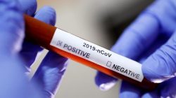 Koronavirüs, Yunanistan’a sıçradı ülkede alarm verildi