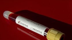 Dünya’da, Koronavirüs bulaşan kişi sayısı 160 bine yaklaştı!