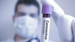 Suriye’de ilk koronavirüs vakası tespit edildi