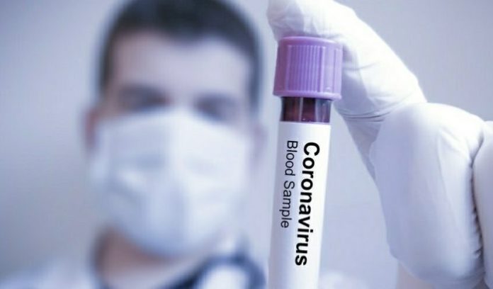  Suriye’de ilk koronavirüs vakası tespit edildi