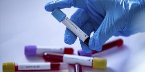 Yurt Dışında Koronavirüsten Ölen Türklerin sayısı ne kadar