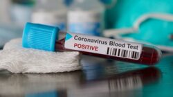 Van, Edremit’te koronavirüs dehşeti! 12 kişinin testi pozitif çıktı