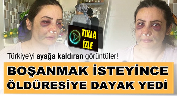  İstanbul, Kartal’da Bir Kadın Eşinden boşanmak istedi, öldüresiye dövüldü!