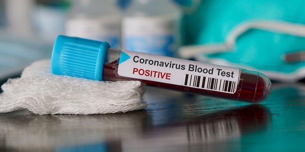  Koronavirüs salgınının merkez üssüden son bilanço açıklandı.