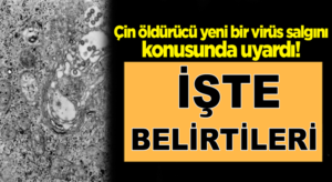 Çin öldürücü yeni bir virüs salgını konusunda uyardı!